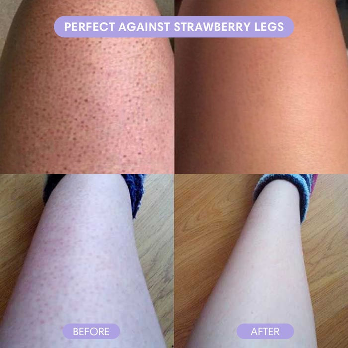 Crystal Hair Removal - Painless Hair Eraser
